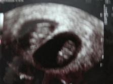 Celine Anja Buntschu 1