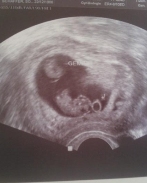 Hannah Sophie Schäffer