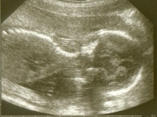 Jason Leon Eiser 2