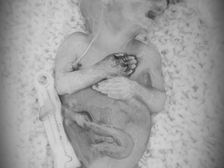 Leon Alexander Krause 13