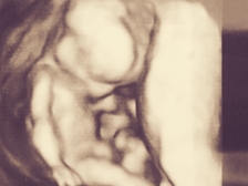 Leon Alexander Krause 6