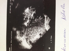 Leonie Larissa Herrmann 2