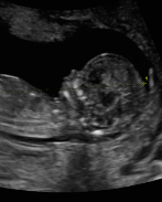 Moritz Von der Heiden