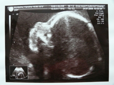 Nina Laura Buntschu 5