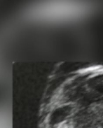 Sternchen Schmetterling